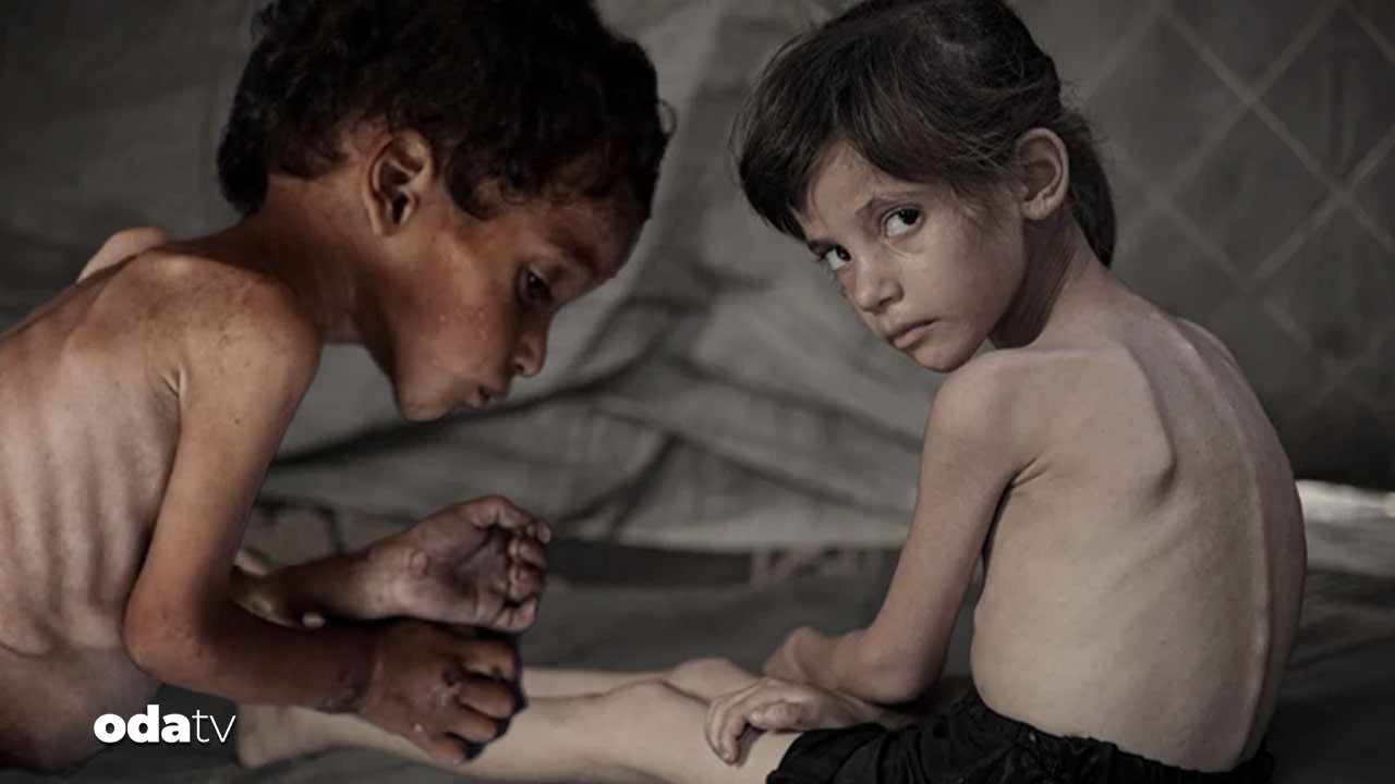 new york times daha fazla dayanamadi gazzede cocuklar acliktan eriyor hayatta kalanlarin gelecegi tehlikede xitWxExW