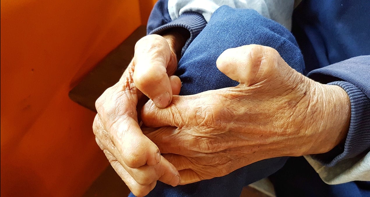 sadece kemikleriniz degil kaslariniz da erimesin u5AJiNCP