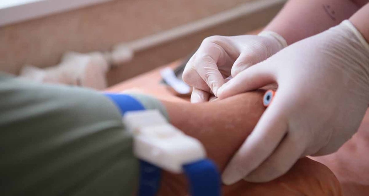 40 yasindan sonra herkesin yaptirmasi gereken 3 kan testi PvnjEVxY.jpg